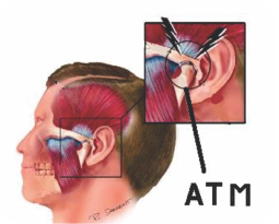 O que é ATM? - Ápex Odontologia